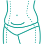 liposuction (1)